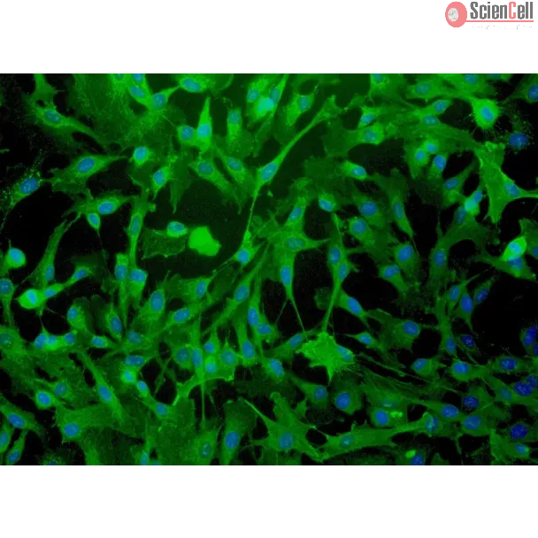 Human Myometrial Smooth Muscle Cells (HMSMC)-Immunostaining for α-sma, 200x.
