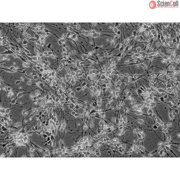 Human Neurons-midbrain (HN-mb) - Phase contrast, 200x.

