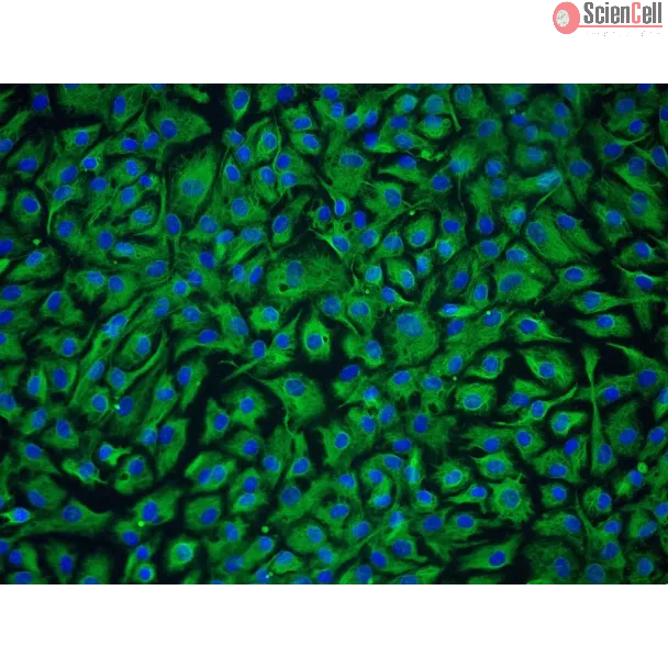 Human Nucleus Pulposus Cells (HNPC) - Immunostaining for Vimentin, 200x.
