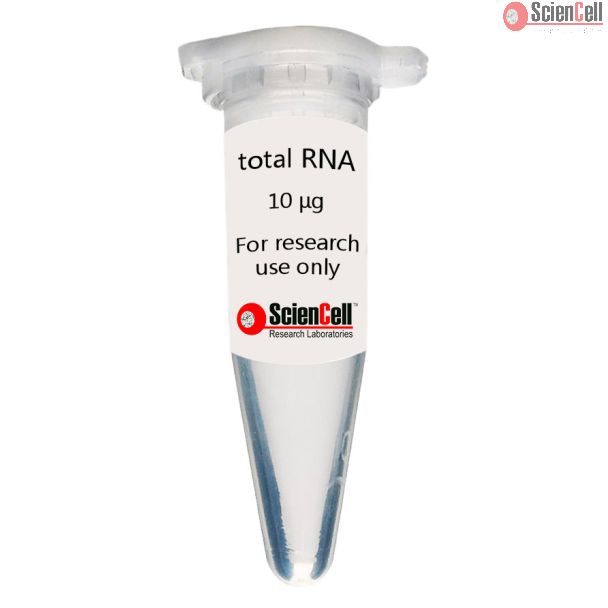 Human Oral Keratinocyte Total RNA