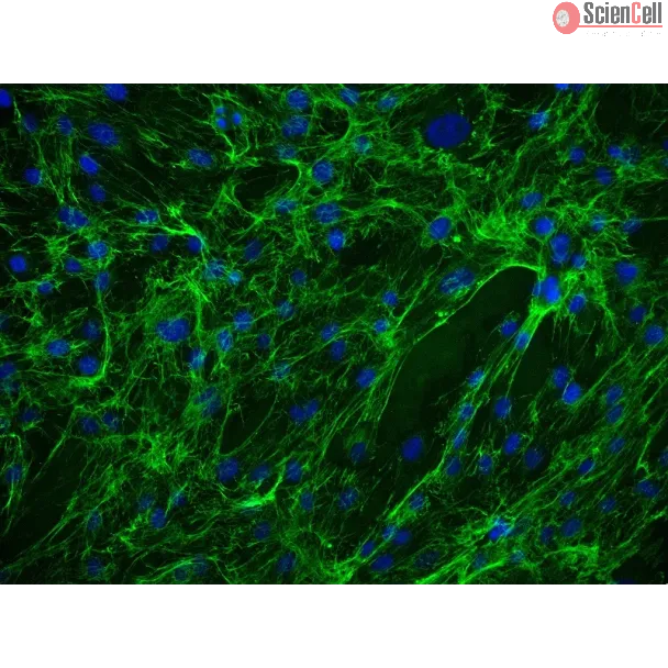 Human Ovarian Fibroblasts (HOF) - Immunostaining for Fibronectin, 200x.
