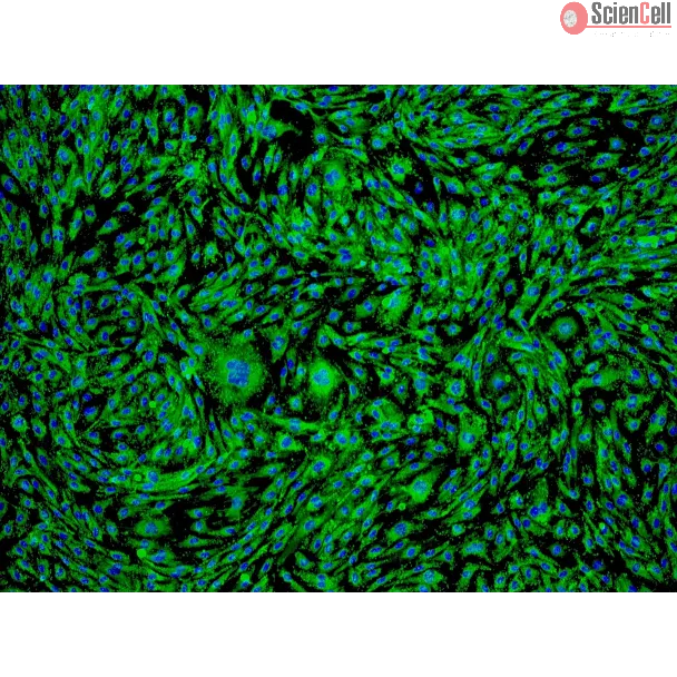 Human Ovarian Microvascular Endothelial Cells (HOMEC) - Immunostaining for vWF, 100x.
