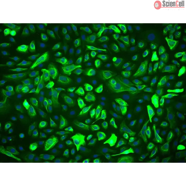 Human Prostate Epithelial Cells (HPrEpiC) - Immunostaining for CK-18, 200x.
