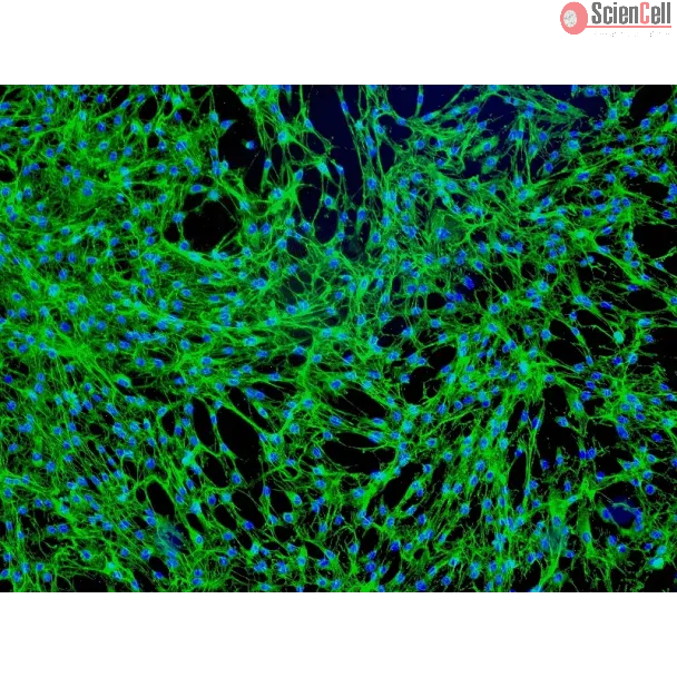 Human Prostate Fibroblasts (HPrF) - Immunostaining for Fibronectin, 100x.
