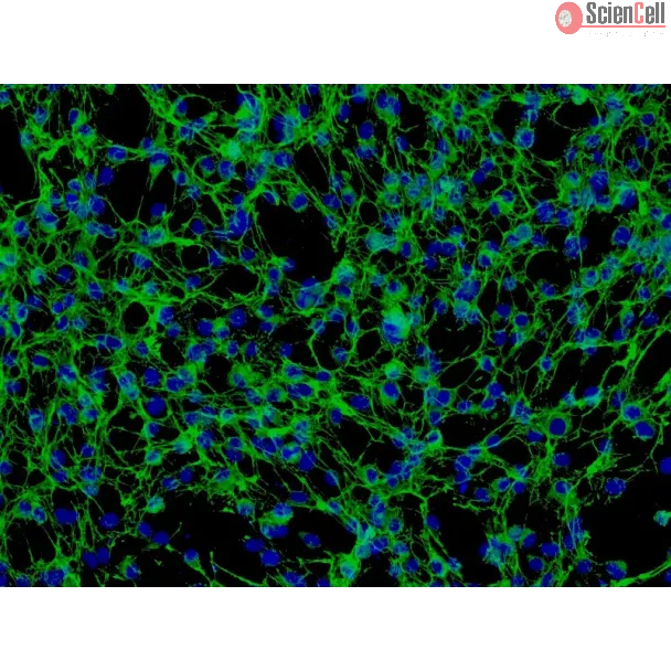 Human Pulmonary Artery Adventitia Fibroblasts (HPAAF) - Immunostaining for Fibronectin, 200x.
