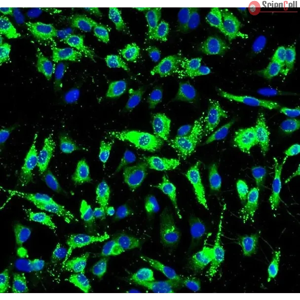 Human Pulmonary Artery Endothelial Cells (HPAEC) - Immunostaining for vWF, 200x.
