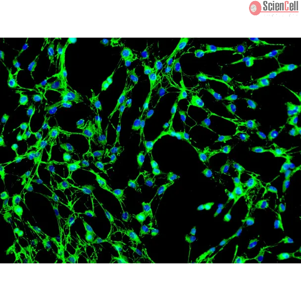 Human Pulmonary Fibroblasts (HPF) - Immunostaining for Fibronectin, 200x.
