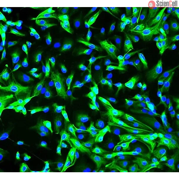 Human Renal Coritcal Epithelial Cells (HRCEpiC) - Immunostaining for CK-18, 200x.
