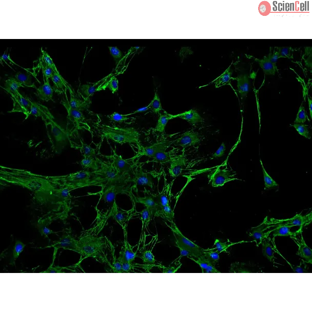 Human Renal Mesangial Cells (HRMC) - Immunostaining for Fibronectin, 200x.