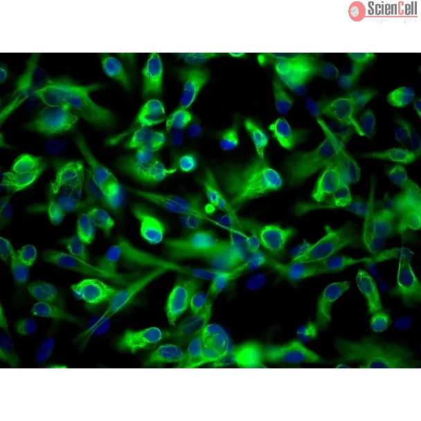 Human Renal Proximal Tubular Epithelial Cells (HRPTEpiC) - Immunostaining for CK-18, 200x.
