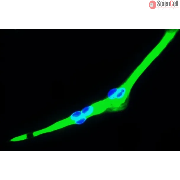 Human Skeletal Muscle Cells (HSkMC) - Immunostaining for Myosin, 400x.
