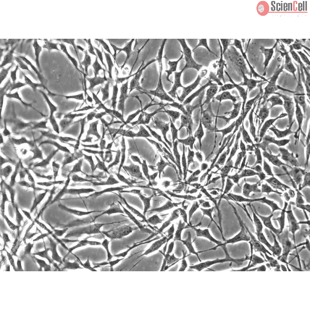 Human Synoviocytes (HS) - Phase contrast, 200x.
