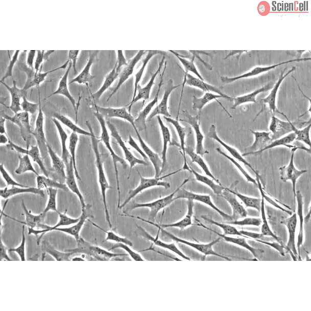 Human Trabecular Meshwork Cells (HTMC) - Phase contrast, 200x.
