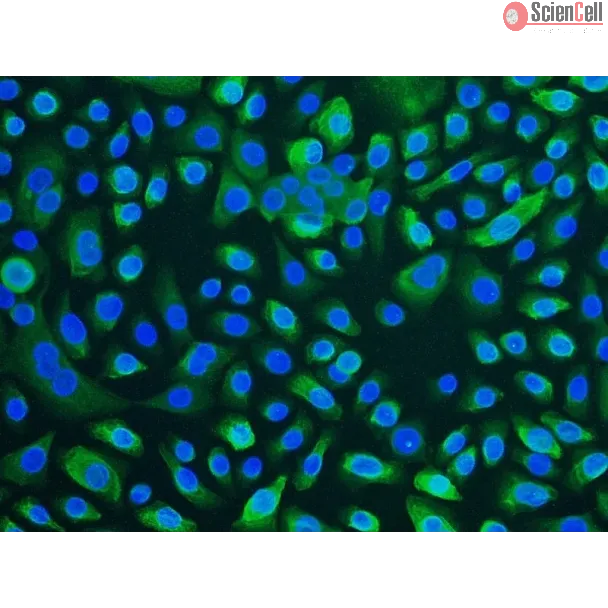 Human Tracheal Epithelial Cells (HTEpiC) - Immunostaining for CK-18, 100x.

