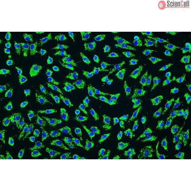 Human Umbilical Artery Endothelial Cells (HUAEC) - Immunostaining for vWF, 200x.
