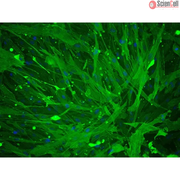Human Umbillical Artery Smooth Muscle Cells (HUASMC) - Immunostaining for α-SMA, 200x.
