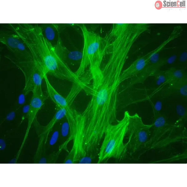 Human Umbilical Vein Smooth Muscle Cells (HUVSMC) - Immunostaining for α-SMA, 400x.
