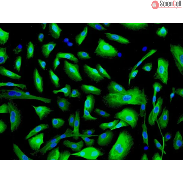 Human Urothelial Cells (HUC) - Immunostaining for CK-19, 200x.
