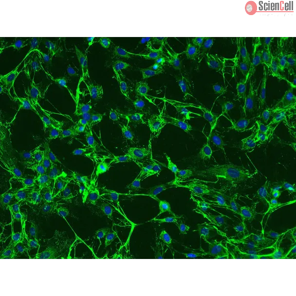 Human Uterine Fibroblasts (HUF)-Immunostaining for Fibronectin, 200x.
