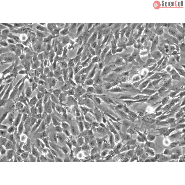 Human Vertebral Mesenchymal Stem Cells (HVMSC) - Phase contrast, 200x.

