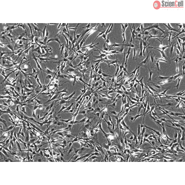 Mouse Astrocytes (MA) - Phase contrast, 100x.
