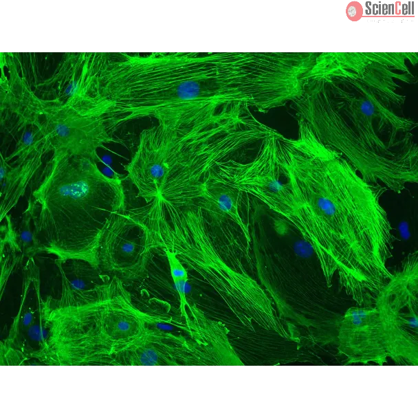 Mouse Brain Vascular Pericytes (MBVP)-Immunostaining for α-SMA, 200x
