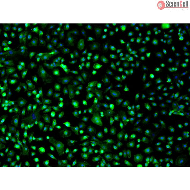 Mouse Hepatic Mesothelial Cells (MHMeC) - Immunostaining for Mesothelin, 200x