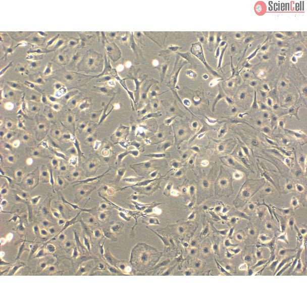 Mouse Hepatic Mesothelial Cells (MHMeC) - Phase Contrast, 100x