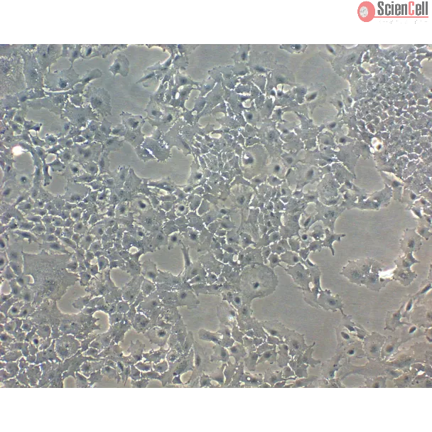 Mouse Lens Epithelial Cells (MLEpiC) - Phase Contrast, 100x