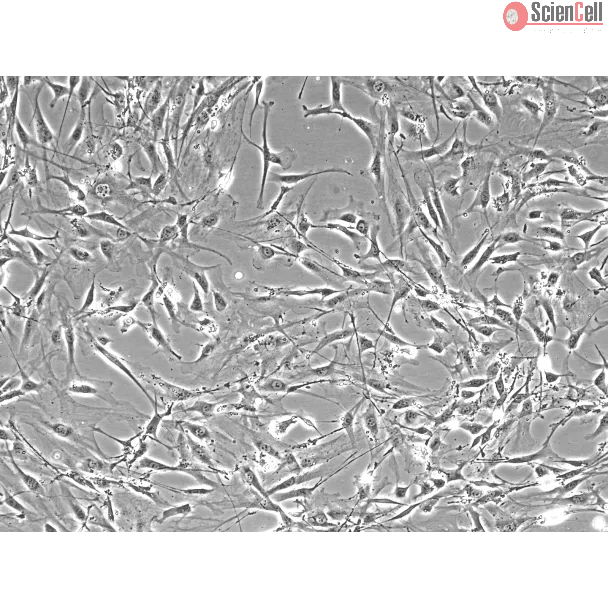 Mouse Lymphatic Fibroblasts (MLF) – Phase Contrast, 100x
