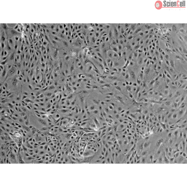 Mouse Renal Proximal Tubular Epithelial Cells (MRPTEpiC) - Phase contrast, 100x.
