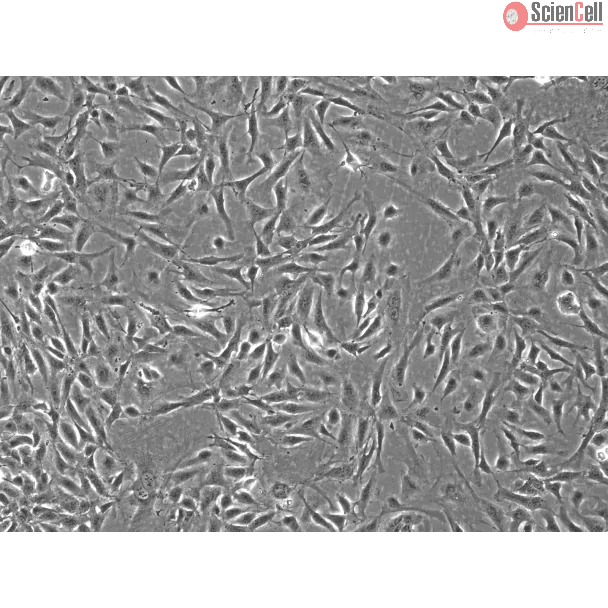 Rabbit Renal Mesangial Cells (RabRMC) – Phase Contrast, 100X.
