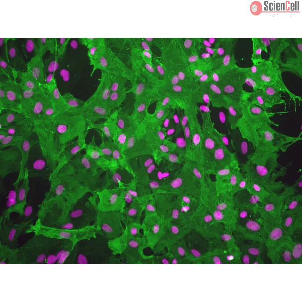Rat Brain Vascular Pericytes (RBVP)-Immunostaining for α-SMA, 200x.
