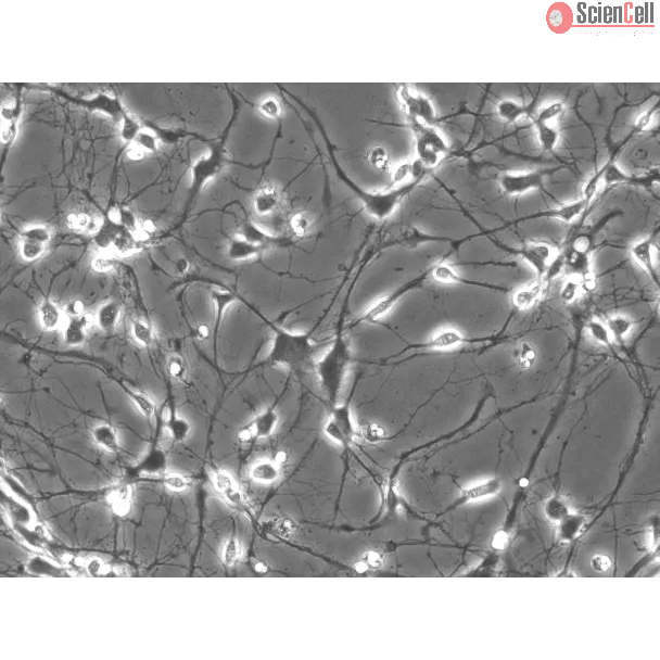 Rat Neurons-striatal (RN-s) - Phase contrast, 200x.
