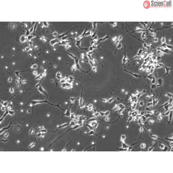 Rat Neurons-substantia nigra (RN-sn) - Phase contrast, 200x.
