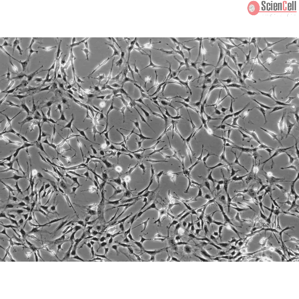 Rat Salivary Gland Fibroblasts (RSGF) - Phase contrast, 100x.
