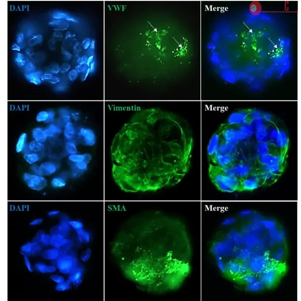 Immunostaining of the hepatic stellate cell-sinusoidal endothelial cell co-culture spheroids with the stellate cell markers (Vimentin and Smooth Muscle Actin) and the endothelial cell marker Von Willebrand Factor . 