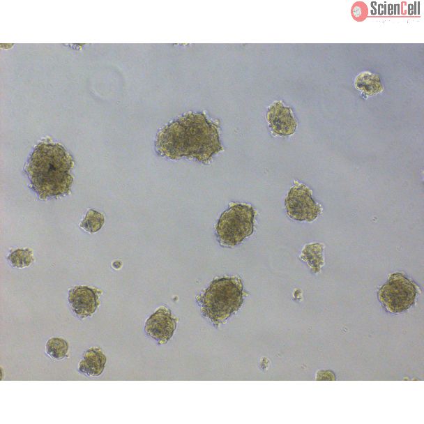 Human Ovarian Fibroblast Spheroids