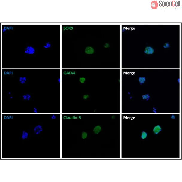 Immunostaining of the human Sertoli cell spheroids with the Sertoli cell markers SOX9 and GATA4 and tight junction marker Claudin-5.