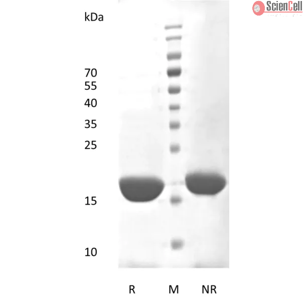 Recombinant Human Interleukin-6