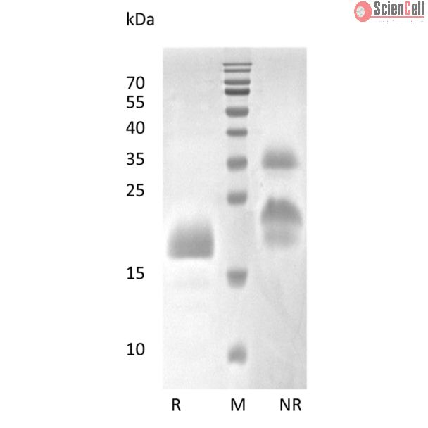 Recombinant Human Vascular Endothelial Growth Factor C
