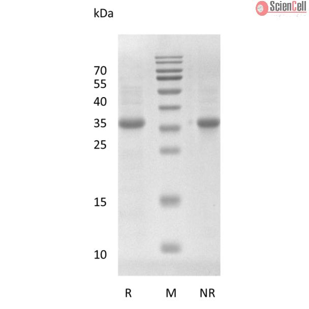 Recombinant Human Wnt-3a Protein, E. coli Derived