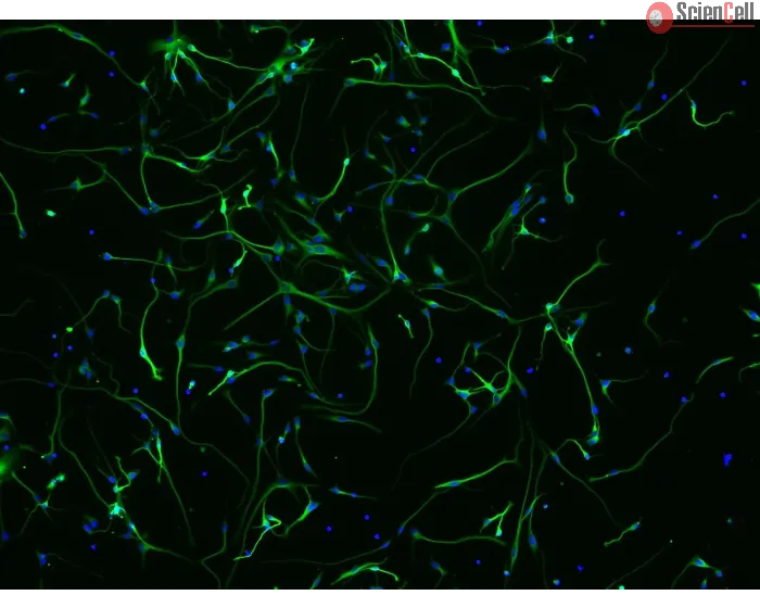 Human Neurons