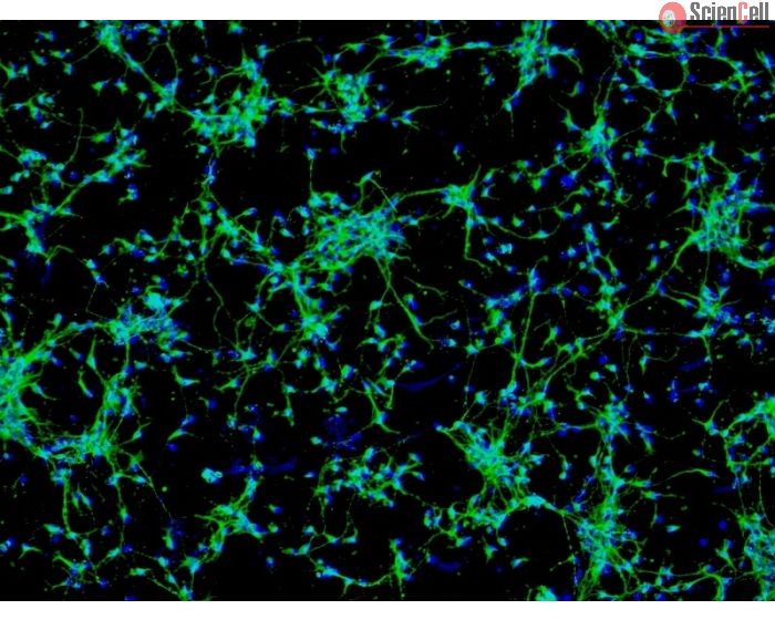 Rat Neurons-raphe (RN-r) - Immunostaining for MAP2, 100x.
