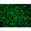 人前列腺上皮细胞（HPrEpiC）- CK-19 免疫染色，100 倍放大。