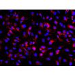 人多能干细胞衍生周细胞（HPSC-P）- PDGFRβ（红色）免疫染色，200倍（200×）
