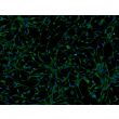 人多能干细胞衍生星形胶质细胞（H9-A）- S100β免疫染色，200x。