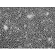人心肌细胞（HCM）- 相差显微镜（Phase contrast），100 倍。