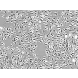 <p>人心脏微血管内皮细胞（HCMEC）- 相衬显微镜，100x。</p>