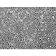 人心脏成纤维细胞（HCF）- 相差显微镜（Phase contrast），100 倍。
